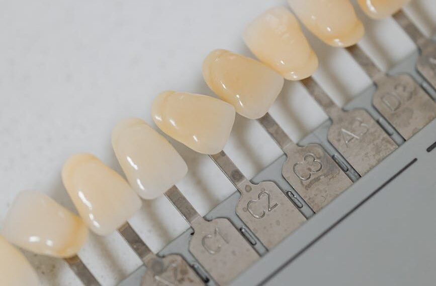 Choosing Wisely: Dental Implants Vs. Dentures For A Lasting Solution 1 Dental Implants Vs Dentures