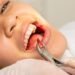 Wisdom Teeth Woes: Understanding The Financial Side Of Removal 8 Wisdom Teeth Removal Cost