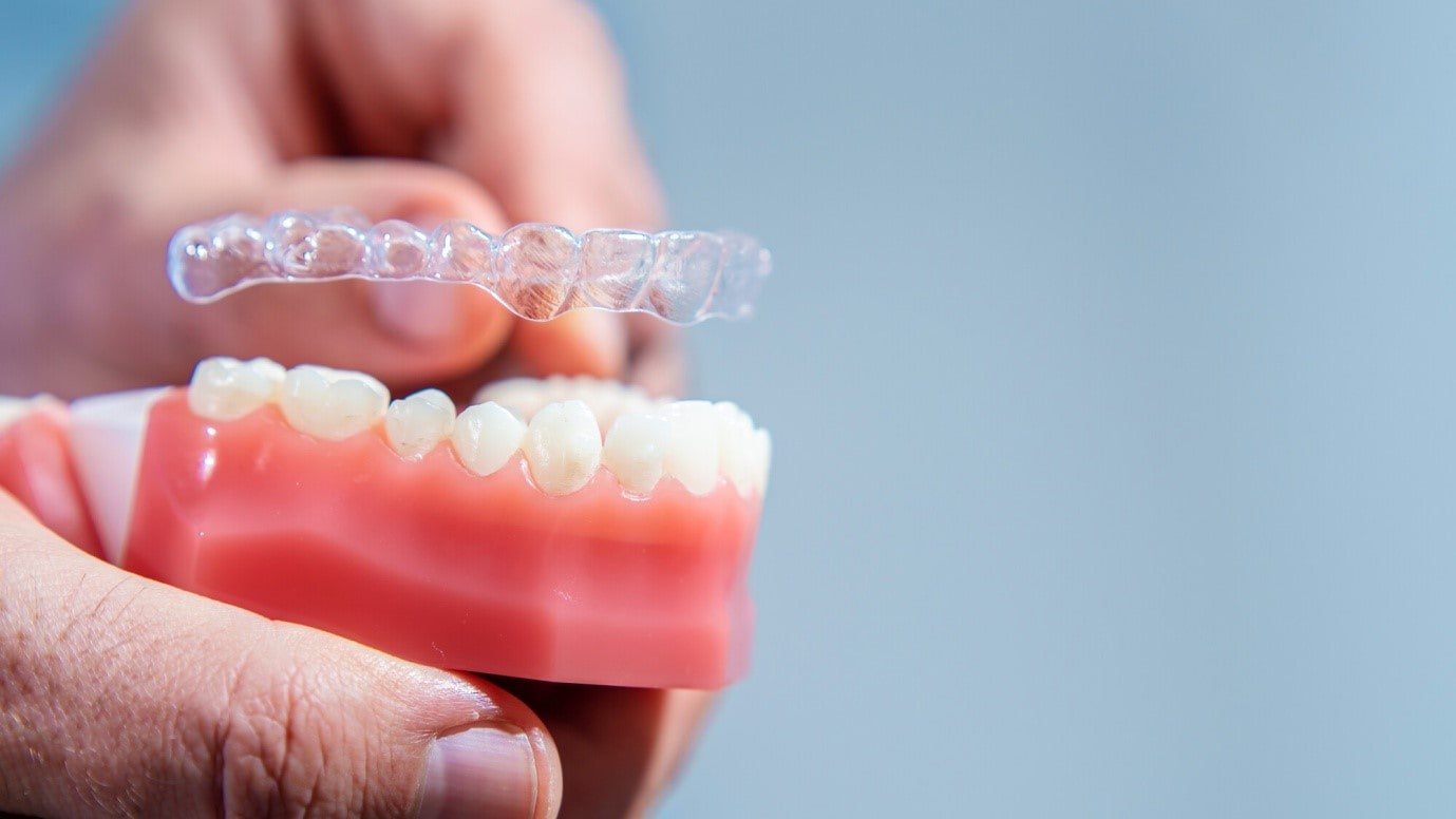 A Patient'S Guide To Basic Invisalign Care