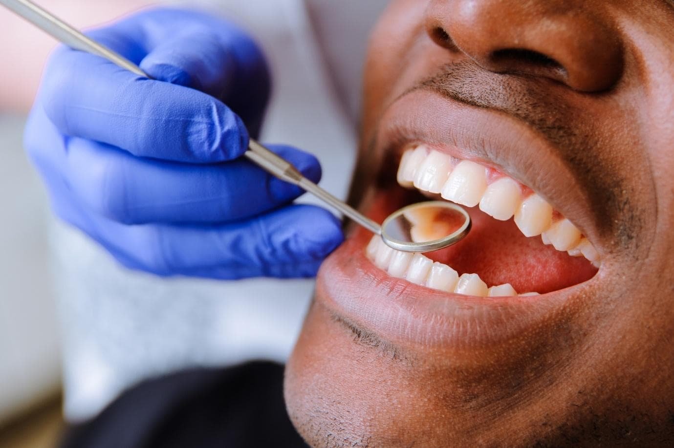 5 Dental Options For Developing A Magnetic Smile
