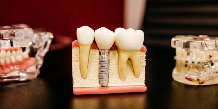 What To Expect From Dental Implants Before And After