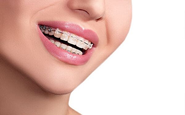 The 6 Dental Treatment Options For Naturally Straight Teeth