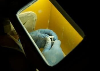 Dental Implants Procedure