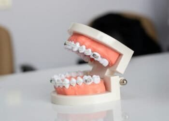 Full Mouth Dental Implants Cost