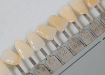 Dental Implants Vs Dentures