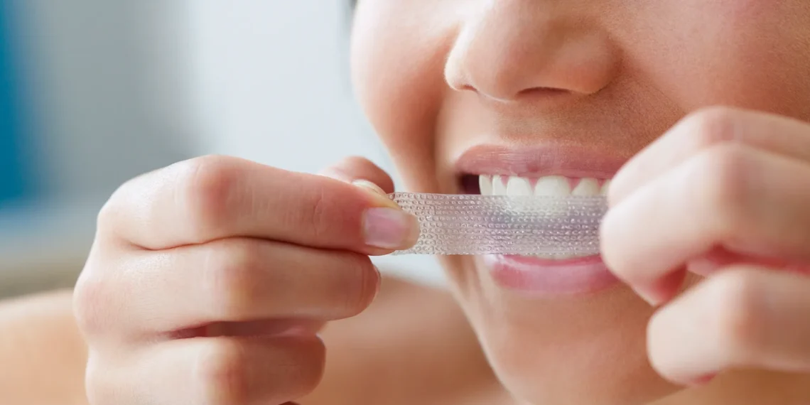 6 Safety Rules For At-Home Whitening From A Cosmetic Dentist In London