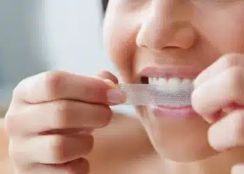 6 Safety Rules For At-Home Whitening From A Cosmetic Dentist In London