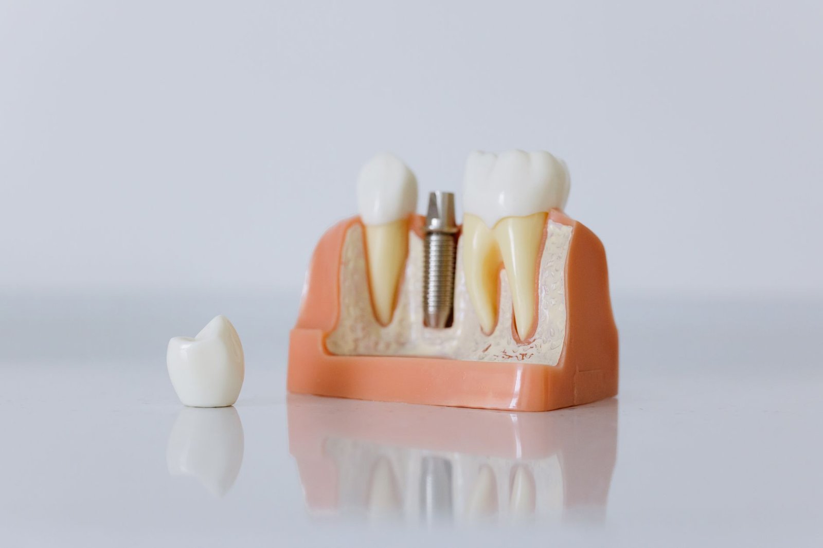 3D printer in a modern dental office creating a tooth restoration, illustrating 2026 dental technology and savings.